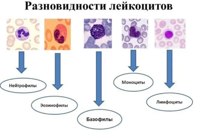 Повышенное содержание базофилов в крови ребенка: причины и возможные последствия Повышенное содержание базофилов в крови ребенка: причины и возможные последствия