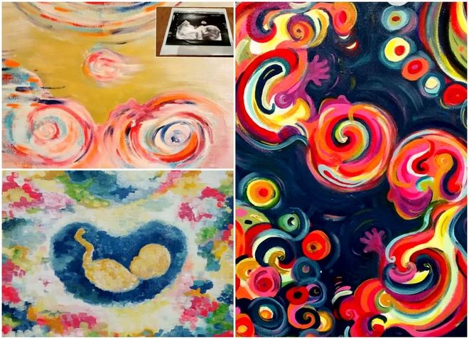 Многодетная мама создает красочные картины из УЗИ беременных женщин