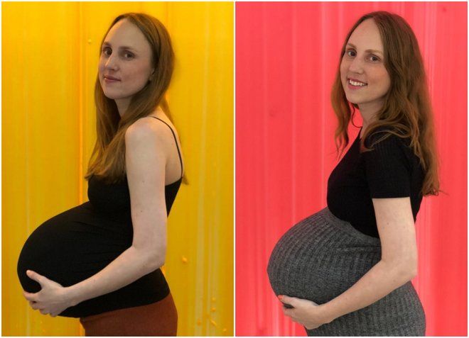 Без прикрас: мама тройняшек показала свою нелегкую беременность